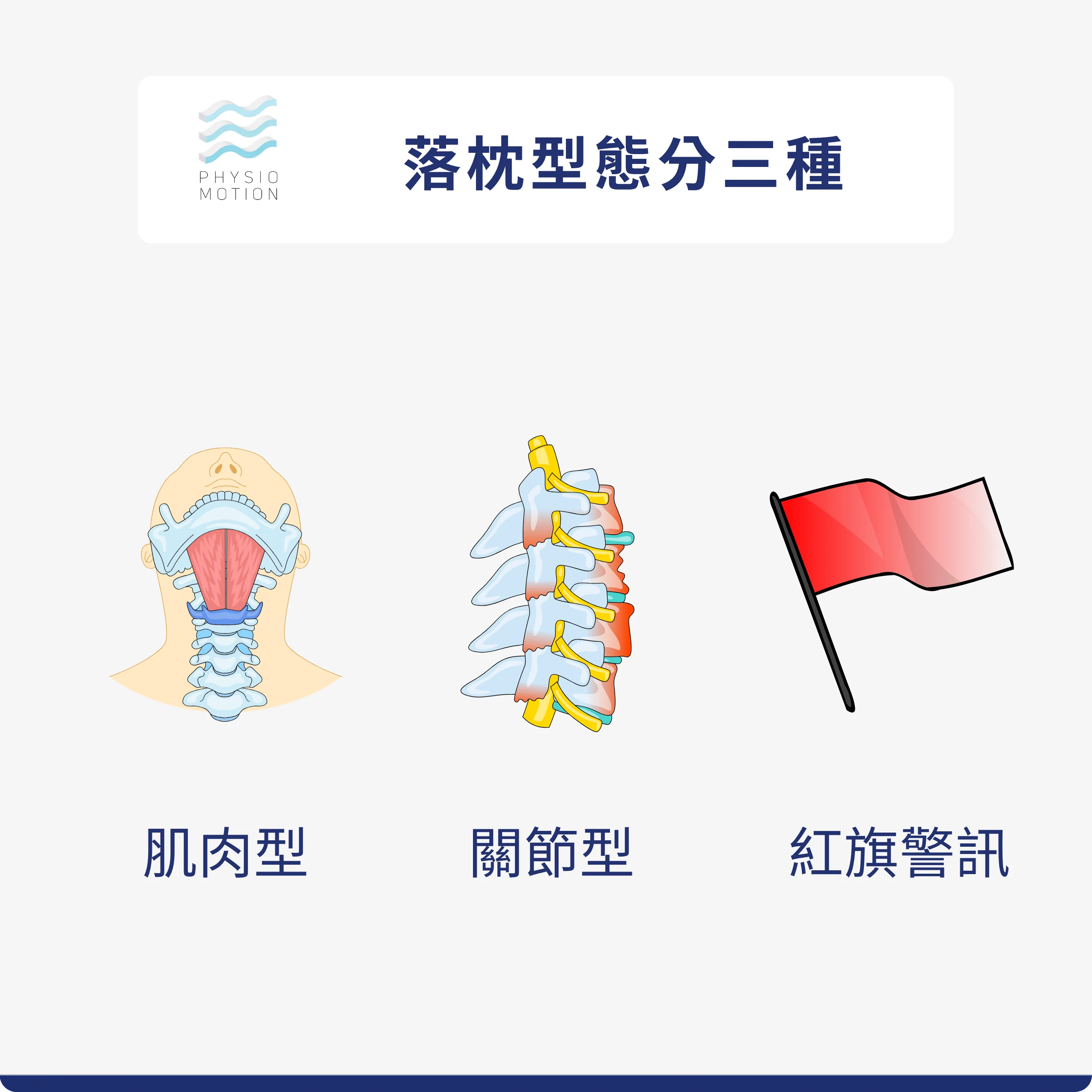 落枕怎麼辦?物理治療師教你急救步驟、伸展動作與預防方法 3 落枕快速判斷