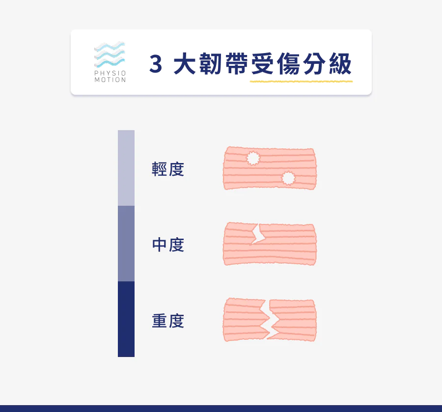 韌帶受傷多久才會好?韌帶拉傷、撕裂傷治療與飲食懶人包一次看 2 3 大韌帶受傷分級