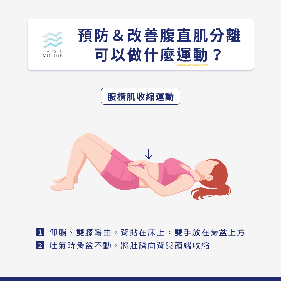 腹直肌分離怎麼辦?4種修復方法教你找回產前的最佳狀態! 4 5. 腹直肌分離 4