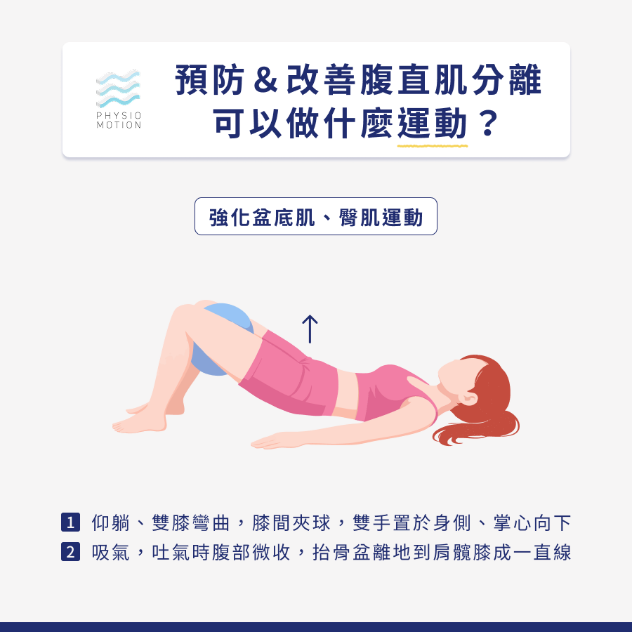 腹直肌分離怎麼辦?4種修復方法教你找回產前的最佳狀態! 5 5. 腹直肌分離 5