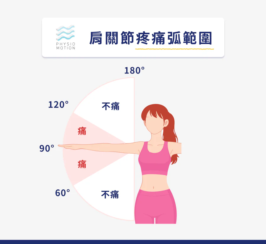 肩夾擠症候群是什麼?舉手會痛的原因可能不是五十肩而是肩夾擠! 2 6. 肩夾擠症候群 2